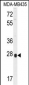 OR8B4 Antibody (C-term)